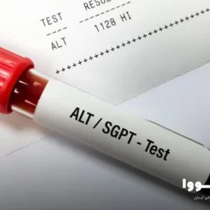 a.l.t در آزمایش خون چیست​