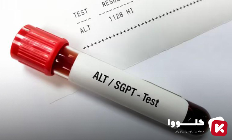 a.l.t در آزمایش خون چیست​